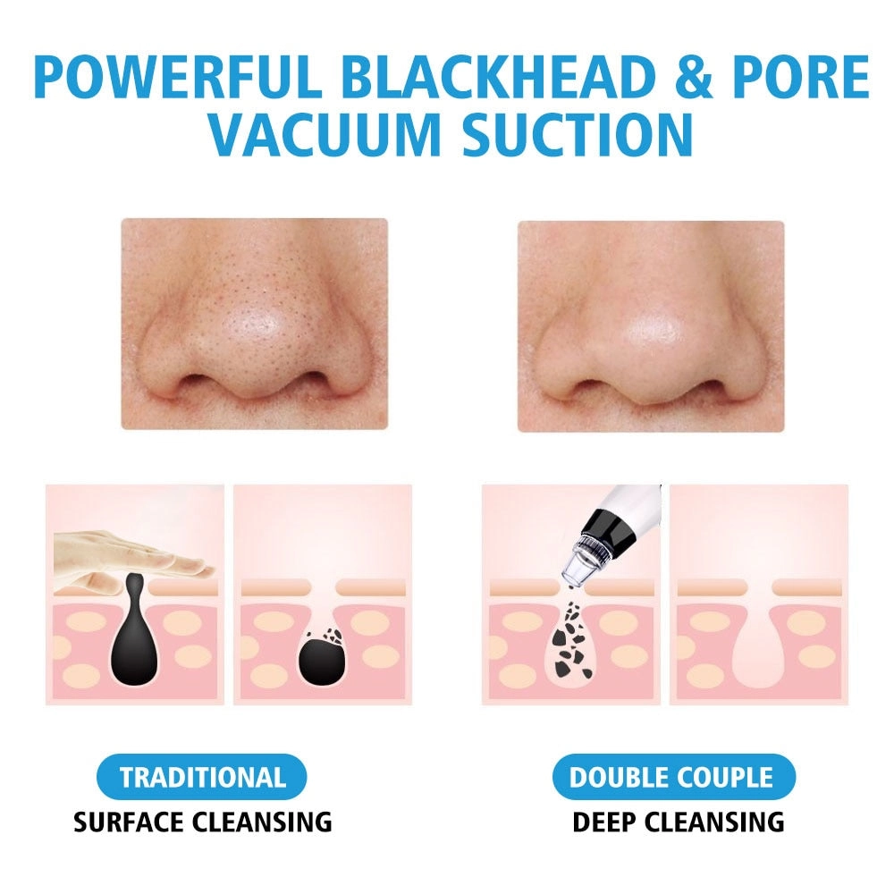 Blackhead Vacuum Suction Pore Vacuum Cleaner Facial Blackhead Acne Removal Tools 3 Colors Light Photon Rejuvenation Skin Care